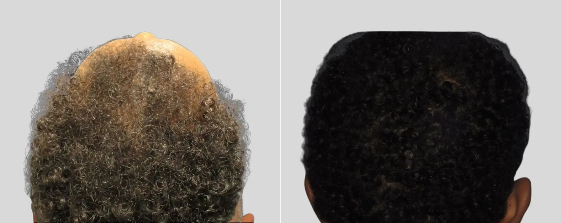 Capture